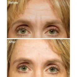 IHerb Health & Beauty FROWNIES Wrinkle Remover Facial Pads Forehead Between Eyes & Mouth 18 Patches 16 IHerb Health & Beauty FROWNIES Wrinkle Remover Facial Pads Forehead Between Eyes & Mouth 18 Patches