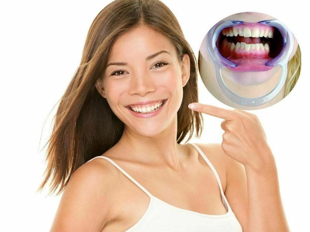 Unbranded 2Pk Of Dental Teeth Whitening Mouth Opener Cheek Lip Retractor Expander Health & Beauty 1 Unbranded 2Pk Of Dental Teeth Whitening Mouth Opener Cheek Lip Retractor Expander Health & Beauty