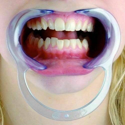 Unbranded 2Pk Of Dental Teeth Whitening Mouth Opener Cheek Lip Retractor Expander Health & Beauty 2 Unbranded 2Pk Of Dental Teeth Whitening Mouth Opener Cheek Lip Retractor Expander Health & Beauty